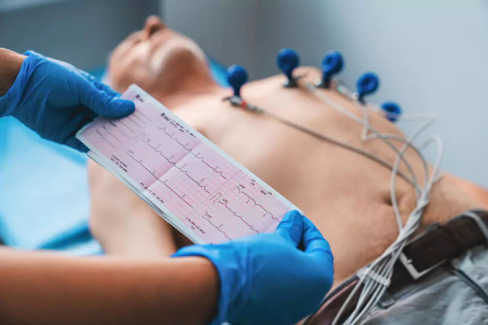 2D Echocardiography (2D Echo)