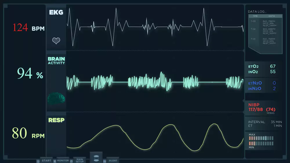 ECG (Electrocardiogram)