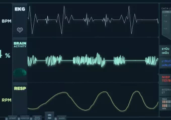ECG (Electrocardiogram) ECG (Electrocardiogram)