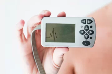 Holter Monitoring Holter Monitoring